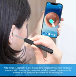 מכשיר חדשני להסרת שעוות אוזניים עם מצלמה 1296P