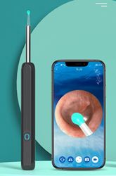 מכשיר חדשני להסרת שעוות אוזניים עם מצלמה 1296P